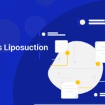 What Does Liposuction Mean?